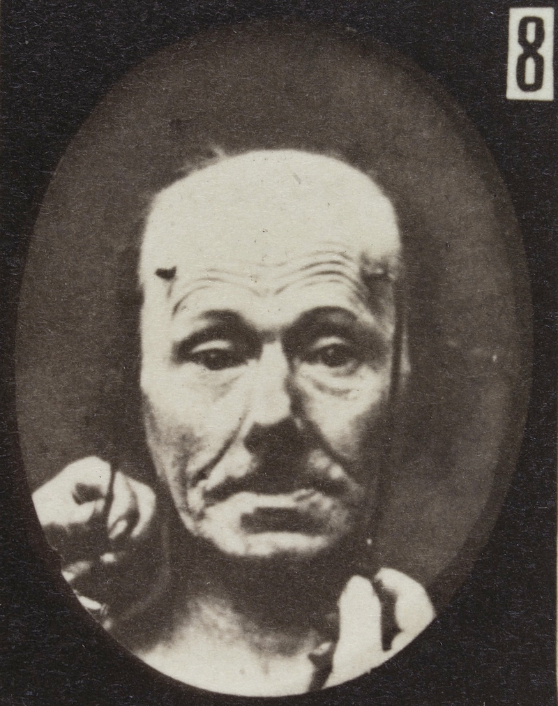 Illustration for article titled Terrifying, Century-Old Photographs from Neuroscience Experiments